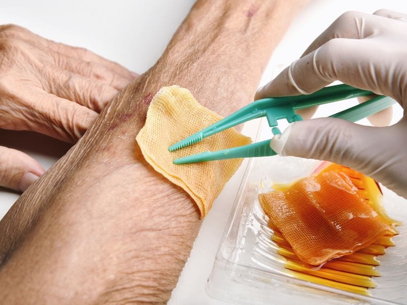 Clínica de Tratamento de Feridas Crônicas em Palhoça