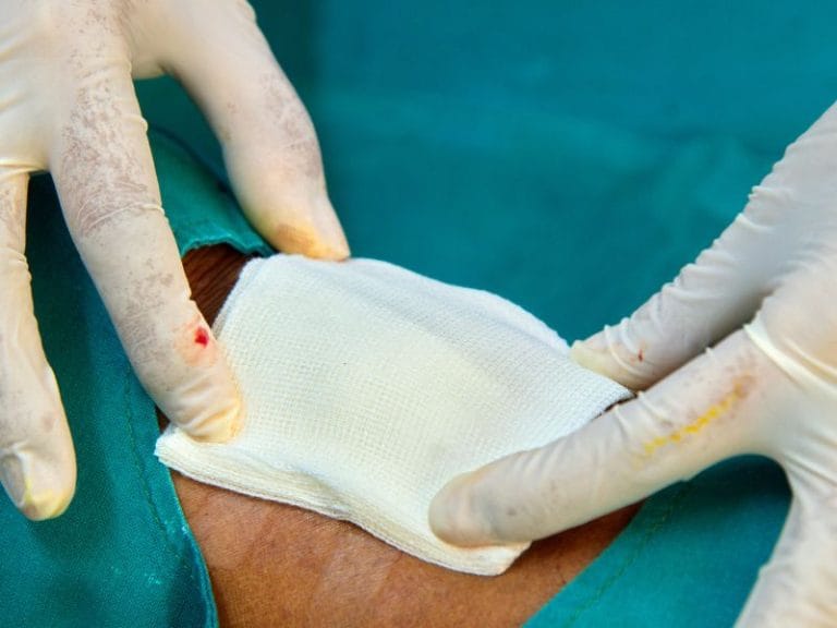 Como Acelerar a Cicatrização de Feridas em Florianópolis