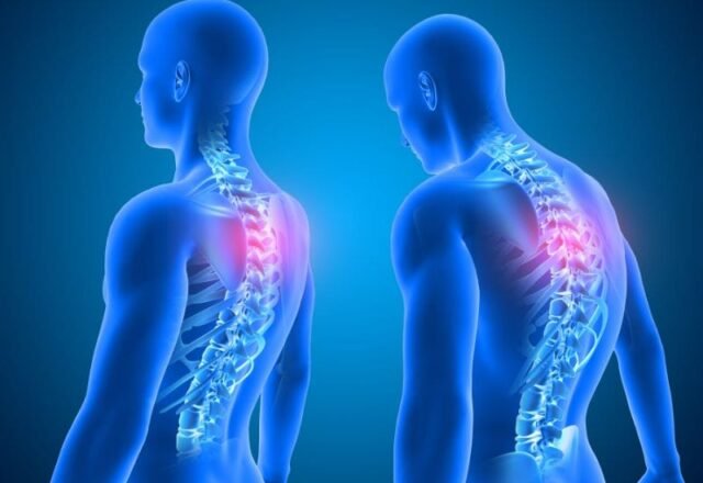 Como Melhorar a Postura e Prevenir Problemas na Coluna Vertebral