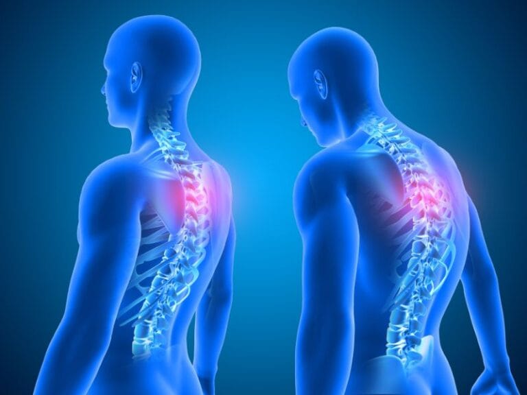 Como Melhorar a Postura e Prevenir Problemas na Coluna Vertebral