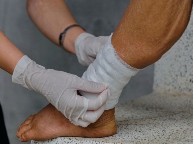 Como Prevenir Complicações em Feridas em Florianópolis