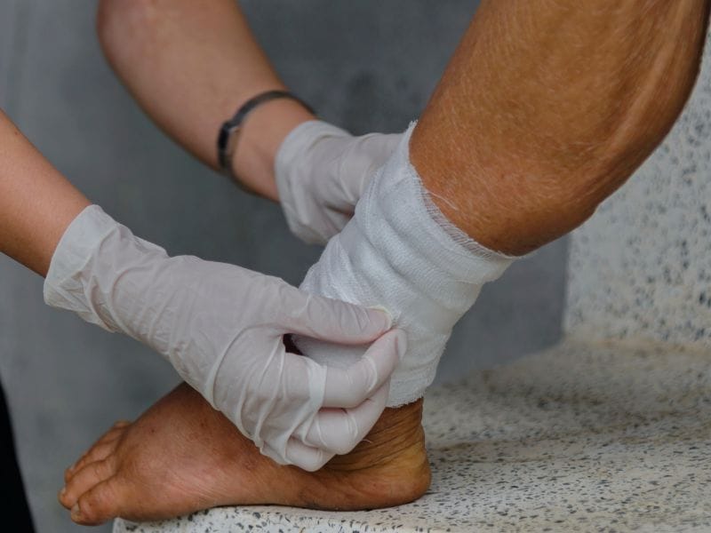 Como Prevenir Complicações em Feridas em Florianópolis