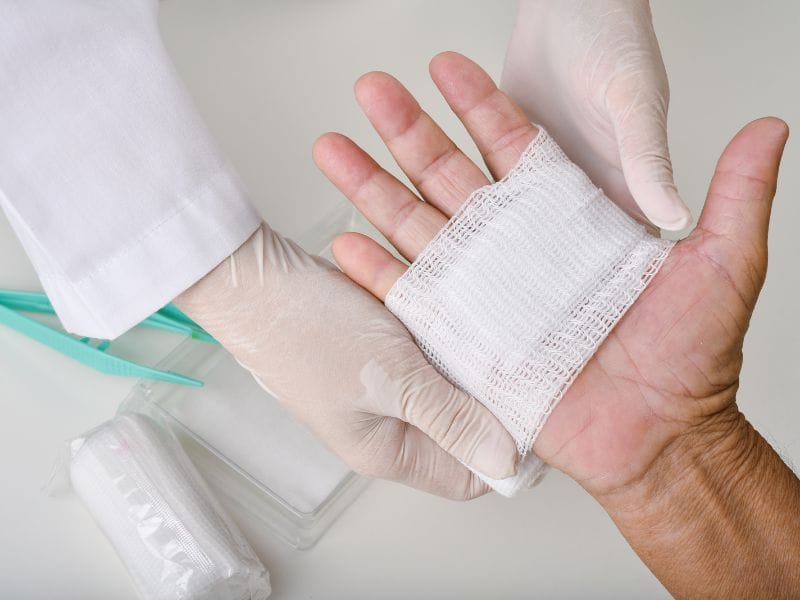 Como Prevenir Complicações em Feridas em São José