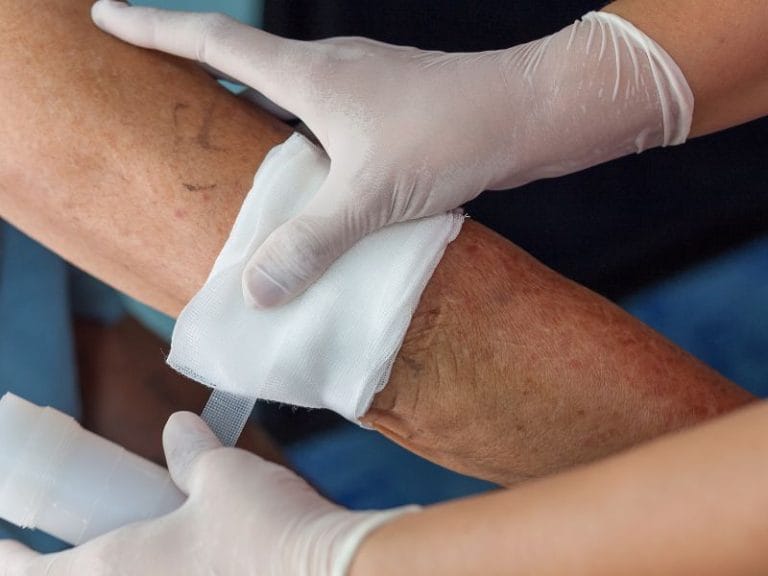 Tratamento de Feridas Abertas em Palhoça