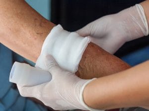 Tratamento de Feridas e Cuidados de Cicatrização em Biguaçu