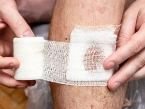 Tratamento de Feridas e Cuidados de Cicatrização em Palhoça