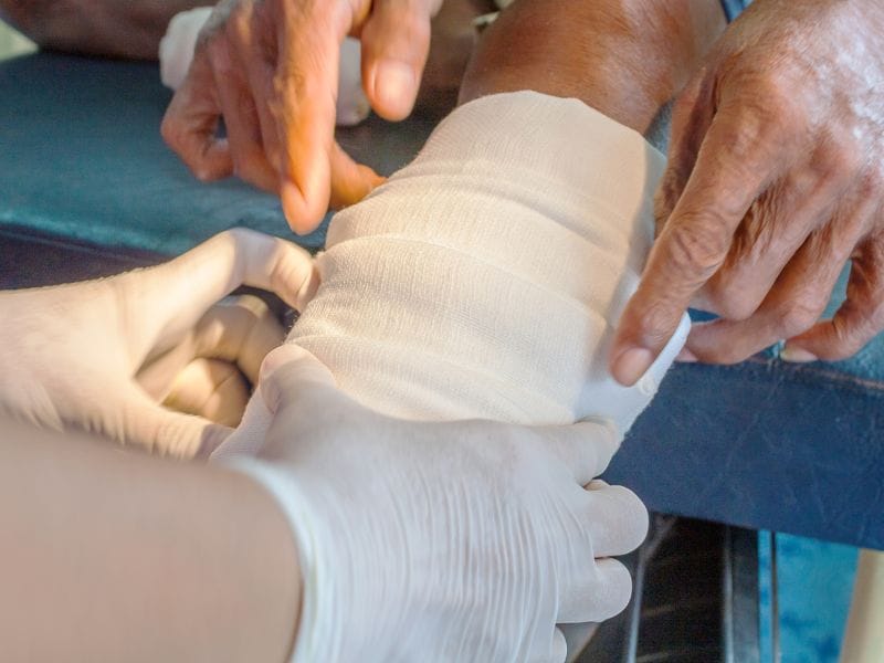 Como Tratar Feridas Crônicas com Qualidade em São José