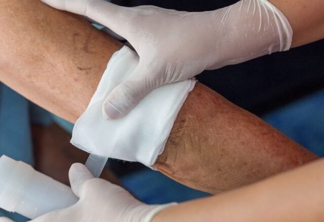 Melhor Clínica para Tratamento de Feridas em Biguaçu