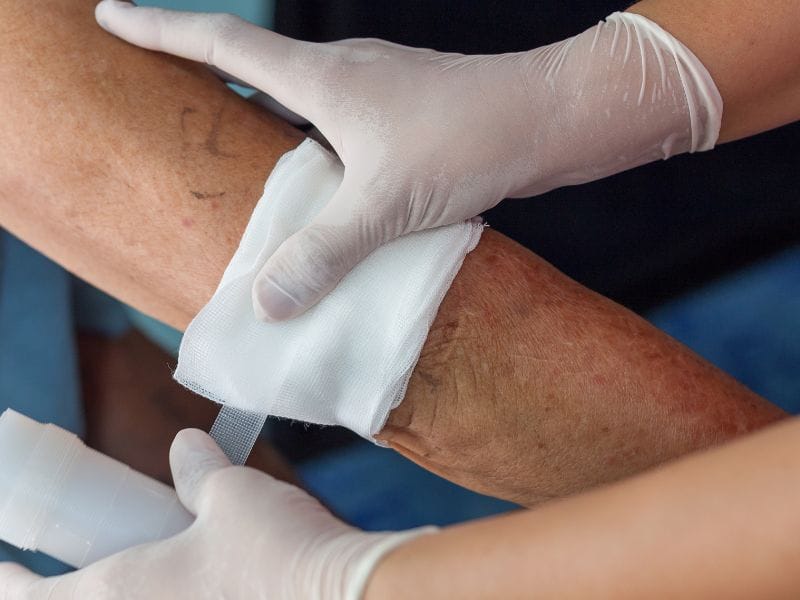 Melhor Clínica para Tratamento de Feridas em Biguaçu