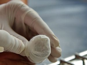 Onde Encontrar Tratamento de Feridas em Biguaçu